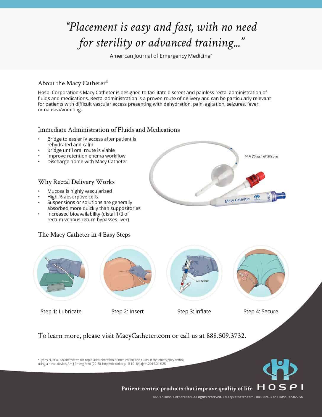 Product Info - The Macy Catheter